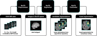 BraTS Toolkit: Translating BraTS Brain Tumor Segmentation Algorithms Into Clinical and Scientific Practice